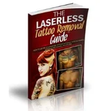 Laserless Tattoo Removal
